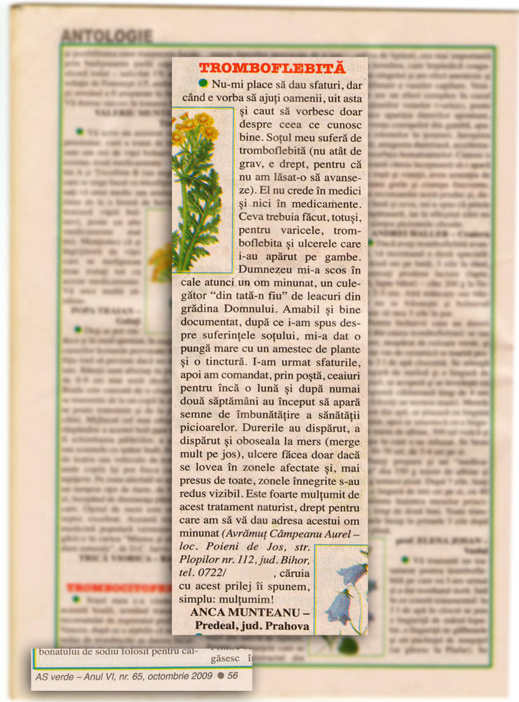 vindeca_tromboflebita